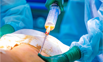 Evropský odbor zdraví